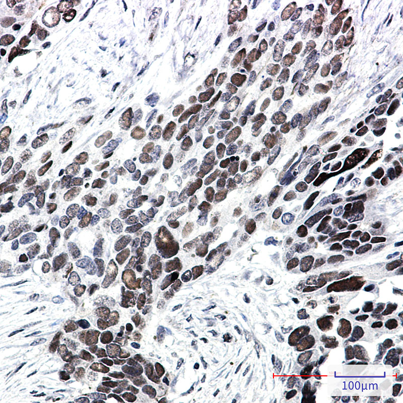 2 - TCF4 Rabbit mAb AP76160