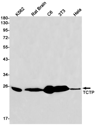 1 - TCTP Rabbit mAb AP76161