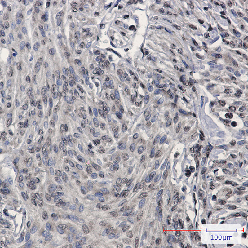 2 - TDP43 Rabbit mAb AP76162