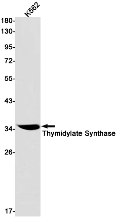 2 - Thymidylate Synthase Rabbit mAb AP76174