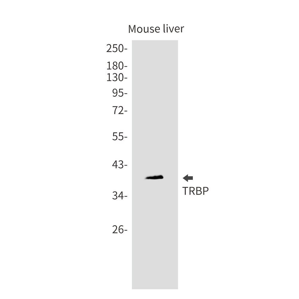 1 - TARBP2 Rabbit mAb AP76198