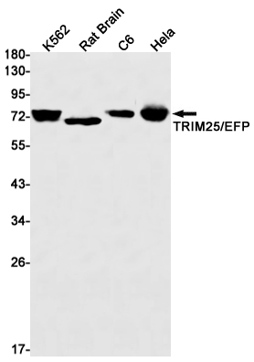 1 - TRIM25 Rabbit mAb AP76204