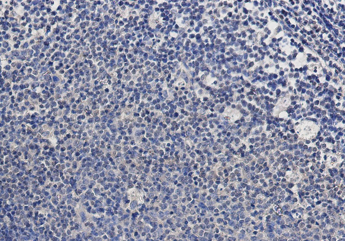 3 - TSG101 Rabbit mAb AP76210