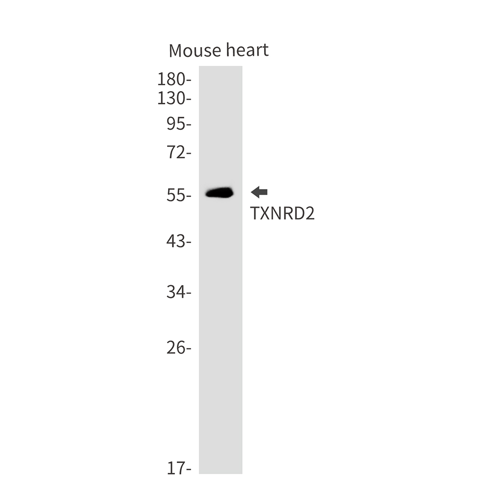 1 - TXNRD2 Rabbit mAb AP76219