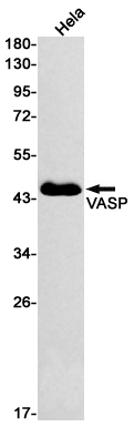 1 - VASP Rabbit mAb AP76238