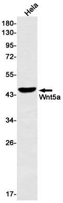 1 - Wnt5a Rabbit mAb AP76261