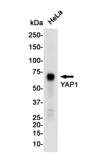 1 - YAP1 Rabbit mAb AP76268