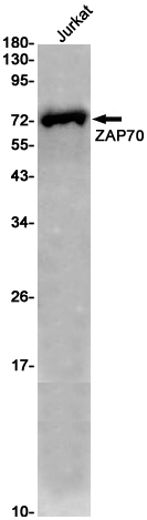 1 - ZAP70 Rabbit mAb AP76274