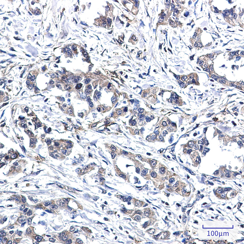 2 - RYK Rabbit mAb AP76288