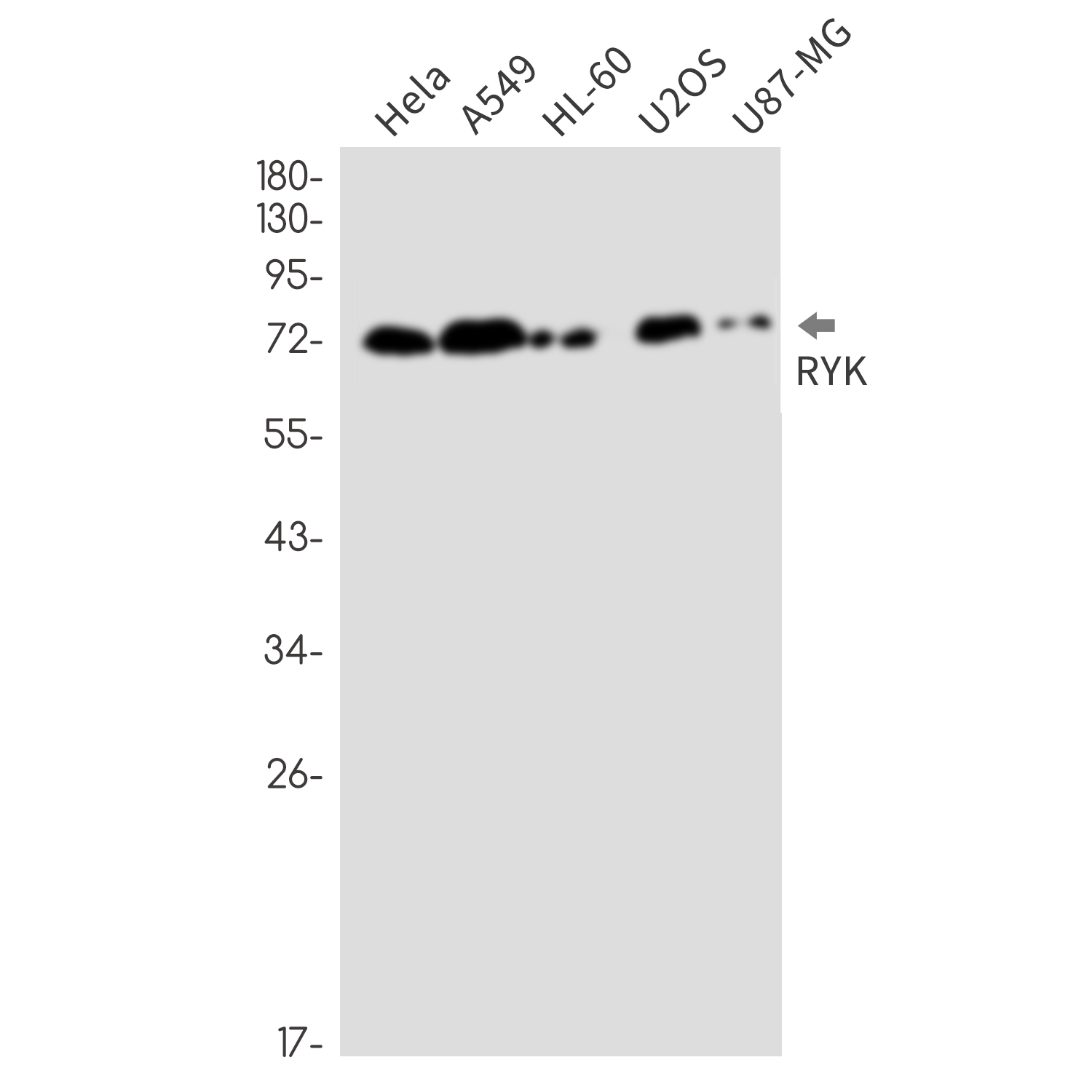 1 - RYK Rabbit mAb AP76288