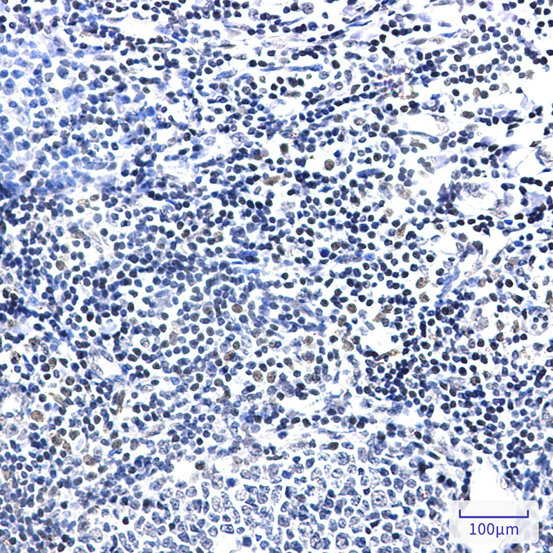 2 - PIM1 Rabbit mAb AP76297