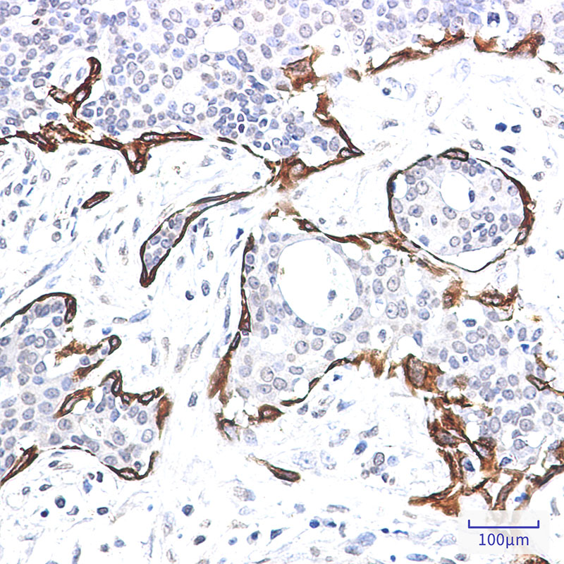 2 - Cytokeratin 17 Rabbit mAb AP76309