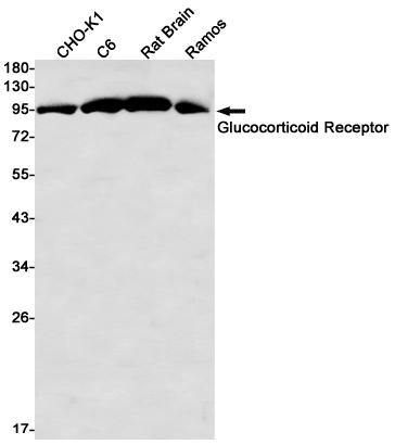 4 - Glucocorticoid Receptor Rabbit mAb AP76320