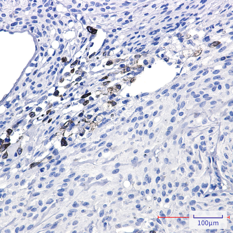 3 - alpha Internexin Rabbit mAb AP76386