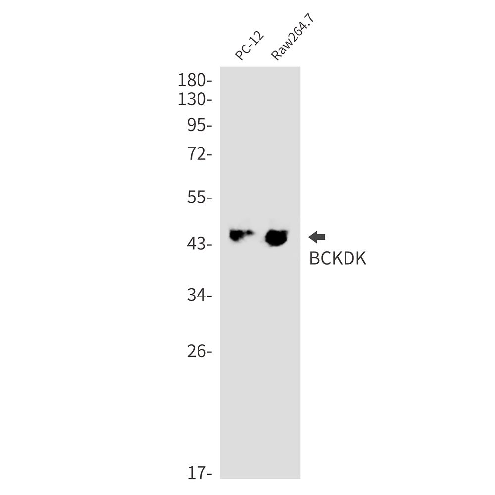 1 - BCKDK Rabbit mAb AP76402