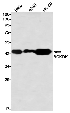0 - BCKDK Rabbit mAb AP76402