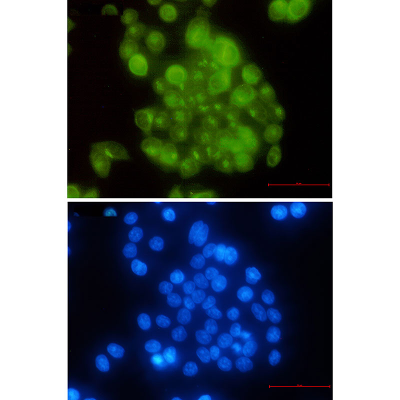 3 - BubR1 Rabbit mAb AP76412