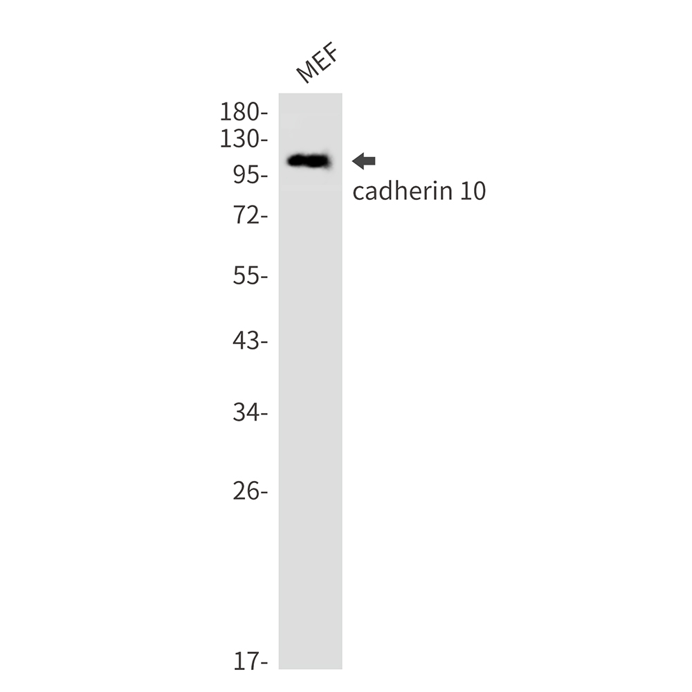 1 - Cadherin 10 Rabbit mAb AP76415
