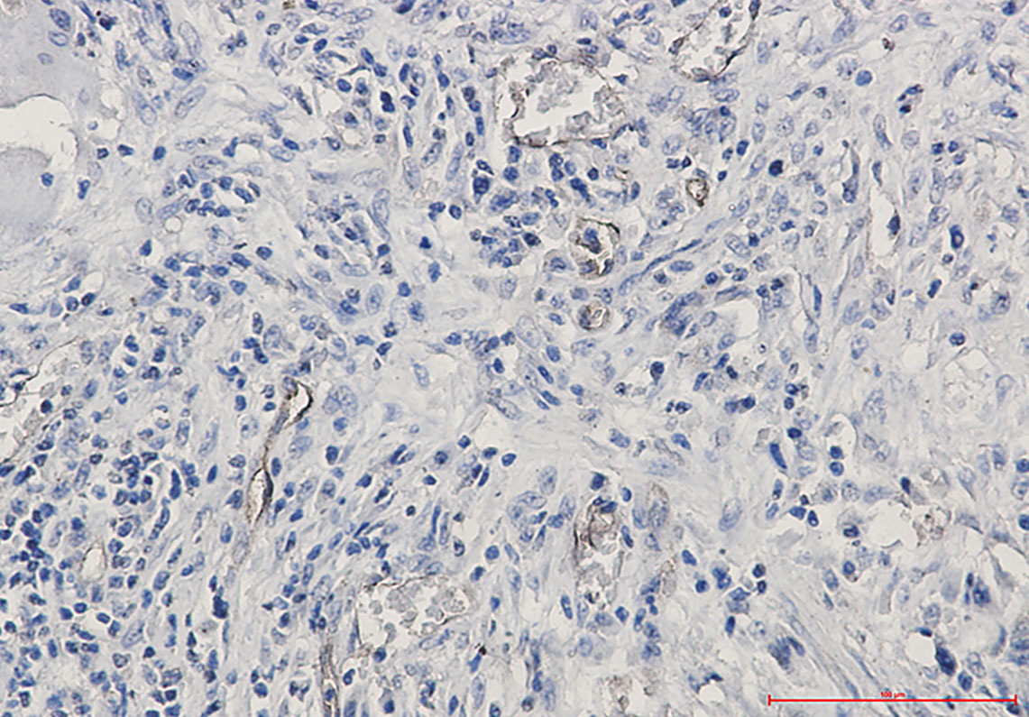 2 - CD105 Rabbit mAb AP76426