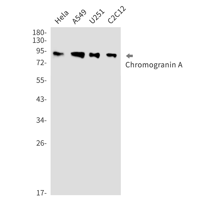 1 - Chromogranin A Rabbit mAb AP76439