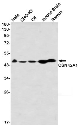 1 - CSNK2A1 Rabbit mAb AP76452
