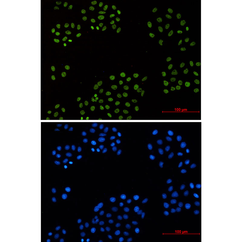1 - Cyclin H Rabbit mAb AP76458