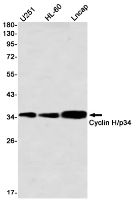 8 - Cyclin H Rabbit mAb AP76458