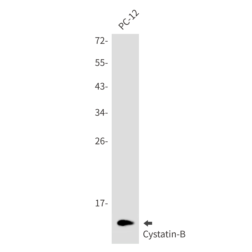 1 - Cystatin B Rabbit mAb AP76461