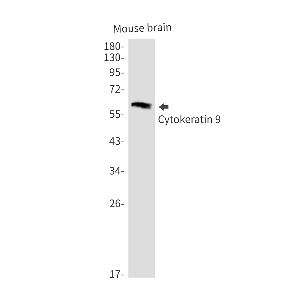 2 - Cytokeratin 9 Rabbit mAb AP76462