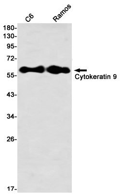 5 - Cytokeratin 9 Rabbit mAb AP76462