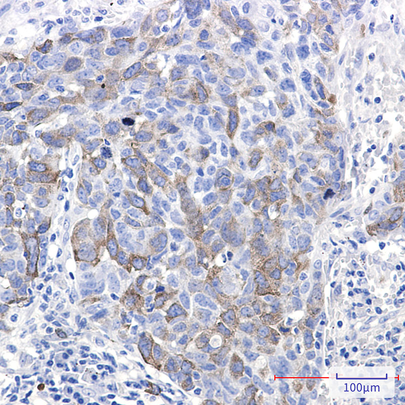 2 - Eg5 Rabbit mAb AP76480