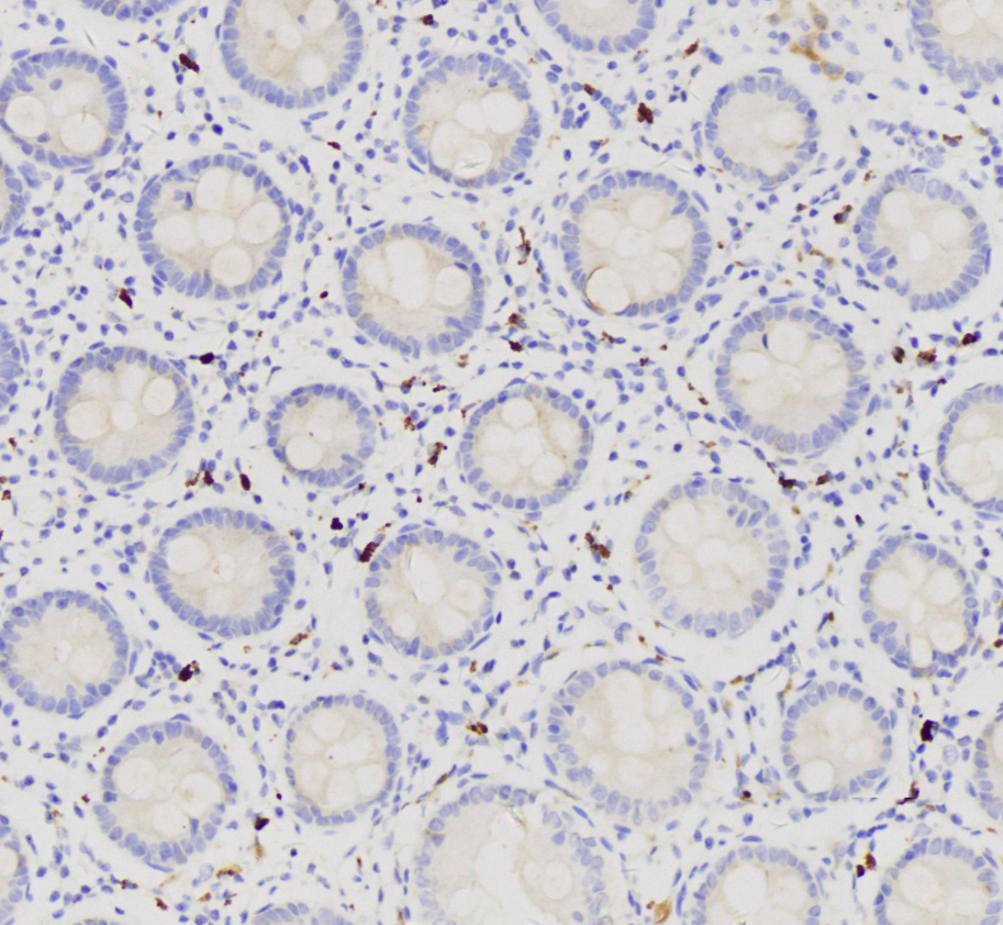 0 - Anti Human 2SC Polyclonal Antibody AD80597