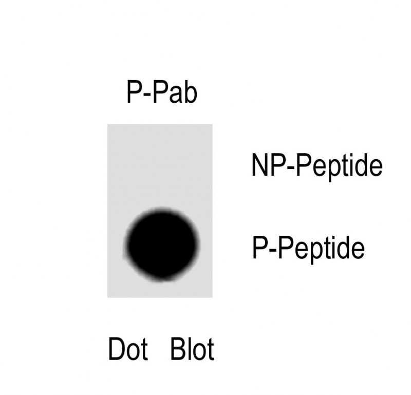 1 - Phospho-MAP3K7IP1-pS423 AP3929a